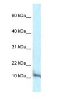 Western Blot: PCBD1 Antibody [NBP1-82376]