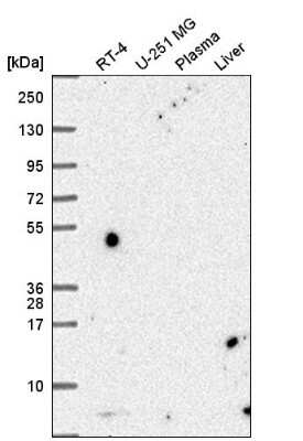 Western Blot: PCBD1 Antibody [NBP2-57448]