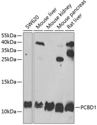 Western Blot: PCBD1 AntibodyBSA Free [NBP2-93878]