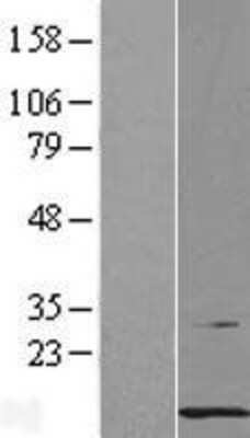 Western Blot: PCBD1 Overexpression Lysate [NBL1-14140]