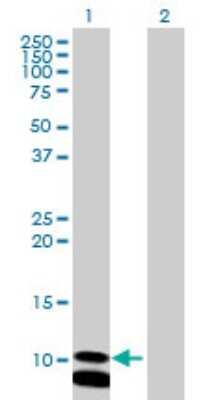 Western Blot: PCBD2 Antibody [H00084105-B01P]