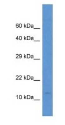 Western Blot: PCBD2 Antibody [NBP1-74264]