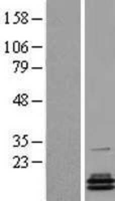 Western Blot: PCBD2 Overexpression Lysate [NBL1-14141]