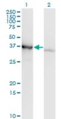 Western Blot: PCBP1 Antibody (1G2) [H00005093-M01]