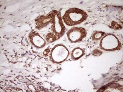 Immunohistochemistry: PCBP1 Antibody (OTI3D12) [NBP2-46336]