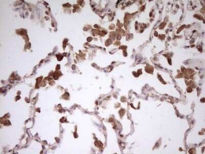 Immunohistochemistry: PCBP1 Antibody (OTI3D12) [NBP2-46336]