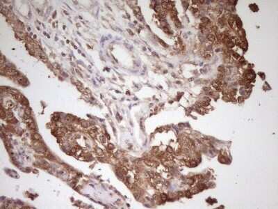 Immunohistochemistry: PCBP1 Antibody (OTI3D12) [NBP2-46336]