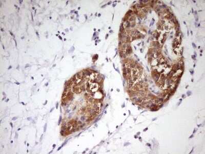 Immunohistochemistry: PCBP1 Antibody (OTI3D12) [NBP2-46336]