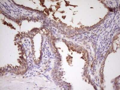 Immunohistochemistry: PCBP1 Antibody (OTI3D12) [NBP2-46336]