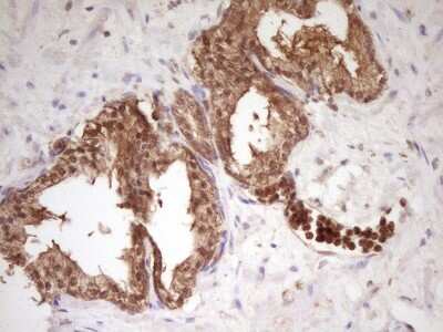Immunohistochemistry: PCBP1 Antibody (OTI3D12) [NBP2-46336]