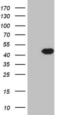 Western Blot: PCBP1 Antibody (OTI3D12) [NBP2-46336]