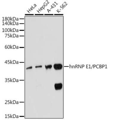 Western Blot: PCBP1 Antibody (7M1K0) [NBP3-15734]