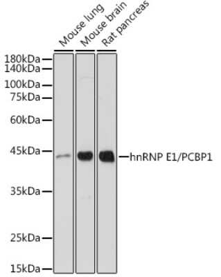 Western Blot: PCBP1 Antibody (7M1K0) [NBP3-15734]
