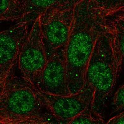 Immunocytochemistry/ Immunofluorescence: PCBP1 Antibody [NBP2-57878]