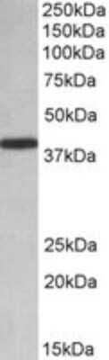 Western Blot: PCBP1 Antibody [NBP1-52114]