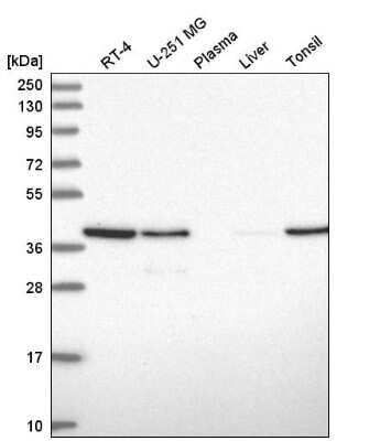 Western Blot: PCBP1 Antibody [NBP2-55063]