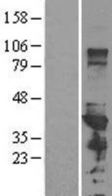 Western Blot: PCBP1 Overexpression Lysate [NBL1-14142]