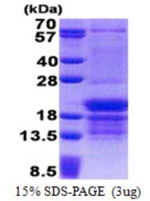 SDS-PAGE: Recombinant Human PCBP1 His Protein [NBP2-23340]