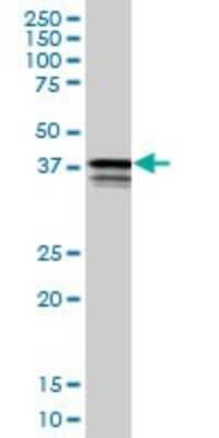 Western Blot: PCBP2 Antibody (1B6) [H00005094-M02]