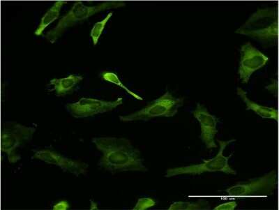 Immunocytochemistry/ Immunofluorescence: PCBP2 Antibody (3A1) [H00005094-M04]