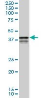 Western Blot: PCBP2 Antibody (3A1) [H00005094-M04]