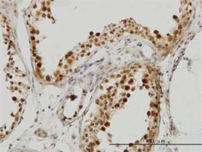 Immunohistochemistry-Paraffin: PCBP2 Antibody (5F12) [H00005094-M07]