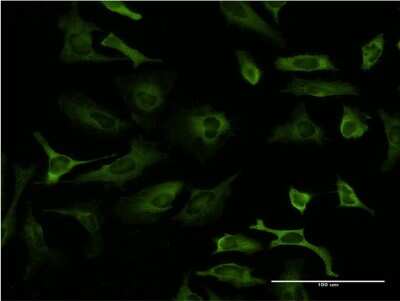 Immunocytochemistry/ Immunofluorescence: PCBP2 Antibody (6B6) [H00005094-M06]