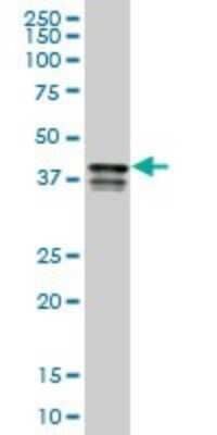 Western Blot: PCBP2 Antibody (6B6) [H00005094-M06]