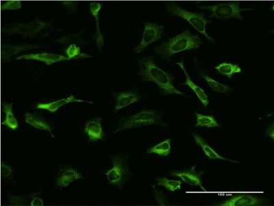 Immunocytochemistry/ Immunofluorescence: PCBP2 Antibody (6E9) [H00005094-M08]