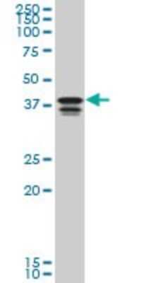 Western Blot: PCBP2 Antibody (6E9) [H00005094-M08]