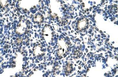 Immunohistochemistry: PCBP2 Antibody [NBP1-57323]