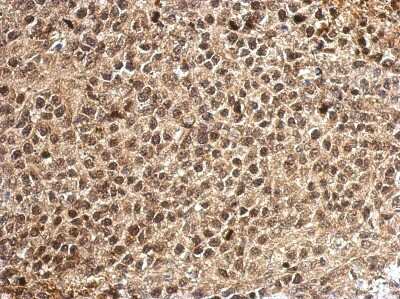 Immunohistochemistry-Paraffin: PCBP2 Antibody [NBP2-19715]