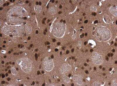 Immunohistochemistry-Paraffin: PCBP2 Antibody [NBP2-19715]