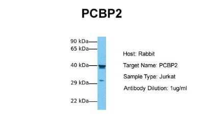 Western Blot: PCBP2 Antibody [NBP1-57323]