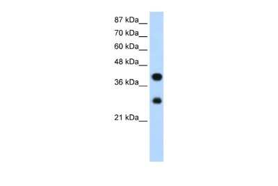 Western Blot: PCBP2 Antibody [NBP1-57323]