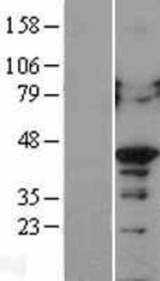 Western Blot: PCBP2 Overexpression Lysate [NBL1-14143]