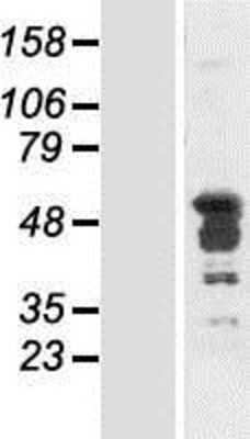 Western Blot: PCBP2 Overexpression Lysate [NBP2-07800]