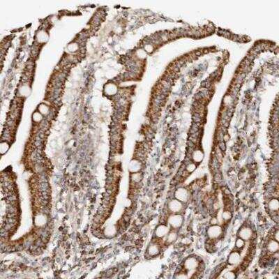 Immunohistochemistry-Paraffin: PCBP3 Antibody [NBP1-89505]