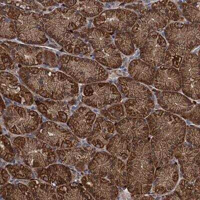 Immunohistochemistry: PCCA Antibody [NBP2-13735]