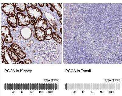 Immunohistochemistry-Paraffin: PCCA Antibody [NBP2-13736]