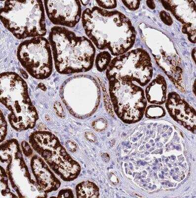 Immunohistochemistry-Paraffin: PCCA Antibody [NBP2-13736]