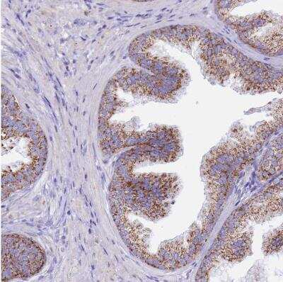 Immunohistochemistry-Paraffin: PCCA Antibody [NBP2-13736]