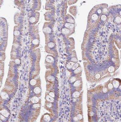 Immunohistochemistry-Paraffin: PCCA Antibody [NBP2-13736]