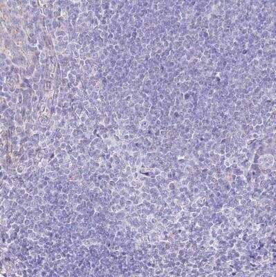 Immunohistochemistry-Paraffin: PCCA Antibody [NBP2-13736]