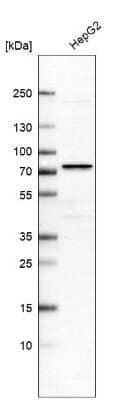 Western Blot: PCCA Antibody [NBP2-13736]