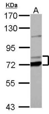 Western Blot: PCCA Antibody [NBP2-19717]