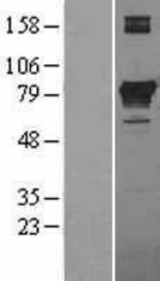 Western Blot: PCCA Overexpression Lysate [NBL1-14146]