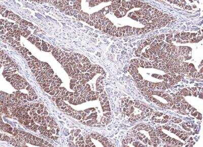 Immunohistochemistry-Paraffin: PCCB Antibody [NBP1-31464]