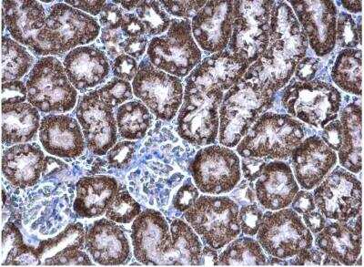 Immunohistochemistry-Paraffin: PCCB Antibody [NBP1-31464]