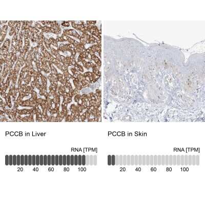 Immunohistochemistry-Paraffin: PCCB Antibody [NBP1-85886]